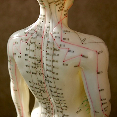 Acupuntura
