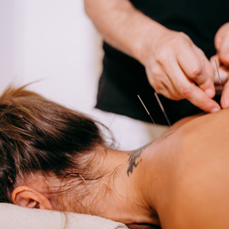 Acupuntura